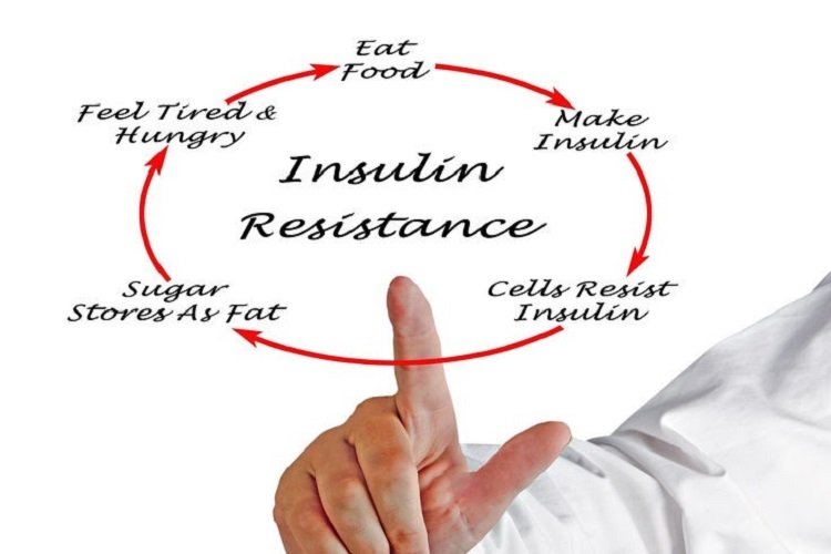 Αντίσταση στην ινσουλίνη